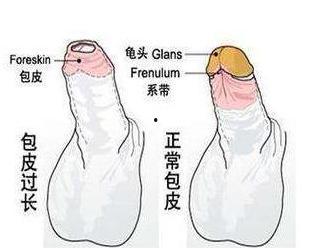 最新成人包皮手术视频,权威视频解析